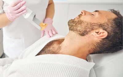 The Benefits of Laser Hair Removal for Men